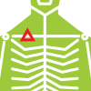 clavicle fracture example