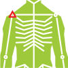 Shoulder instability example