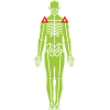 Shoulder joint arthritis example